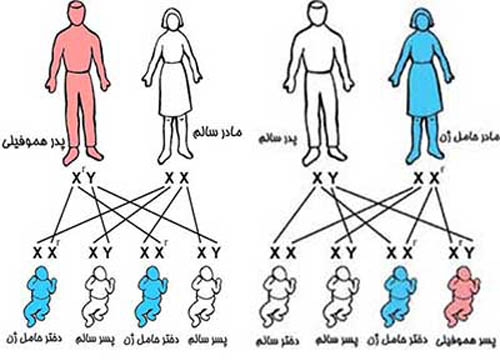 مبتلایان به هموفیلی هم خون می‌خواهند هم مهربانی!///لطفا منتشر نشود درحال تکمیل