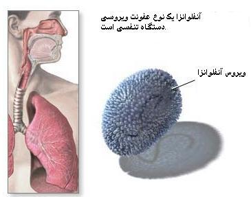 نوع و علامی بیماری آنفلوآنزا