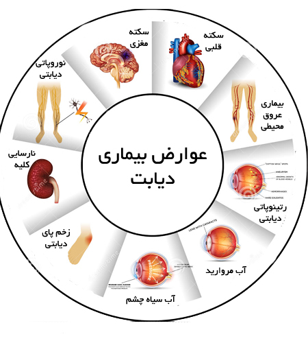 شناسایی ۱۲۵ هزار بیمار مبتلا به دیابت در فارس