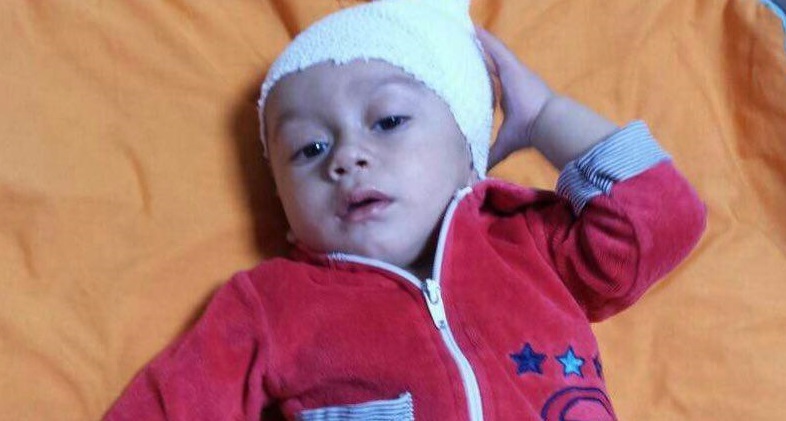 زندگی دوباره کودک هشت ماهه با تلاش تیم درمانی بیمارستان امام رضا (ع) لار