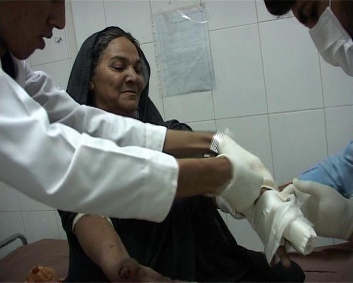 خانم 54 ساله؛ قربانی دیگر حمله سگ های ولگرد در شمال استان
