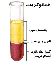 بیماران خاص، نیازمند اهدا پلاکت یا پلاسما