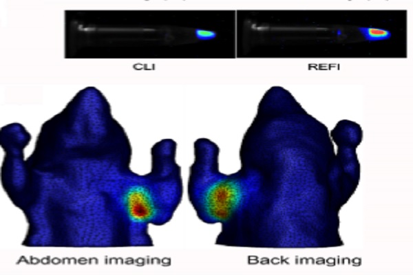 افزایش دقت تصویربرداری سه بعدی از گره‌های لنفاوی