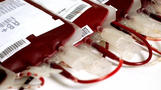 کمبود‌های فصلی خون بیشتر در گروه‌های خونی منفی