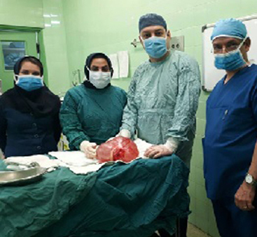 انجام دو جراحی نادر برای خروج توده در شهر فارس