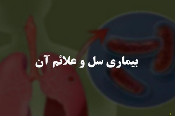 سرفه پایدار شایع‌ترین علامت بیماری سل