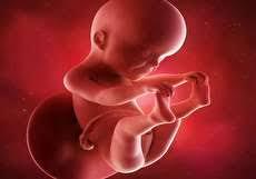 اختلالات ژنتیکی، در دوران جنینی قابل تشخیص است