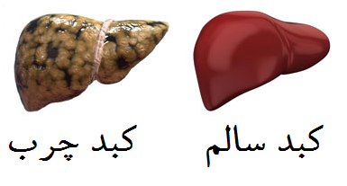 نسخه غذایی برای پاکسازی کبد