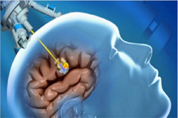 تجهیز ۶ مرکز درمانی به تجهیزات پیشرفته علوم شناختی