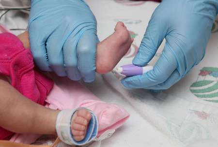 آغاز طرح غربالگری متابولیک ارثی در نوزادان