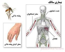 کاهش 31 درصدی میزان بروز سالک در سبزوار