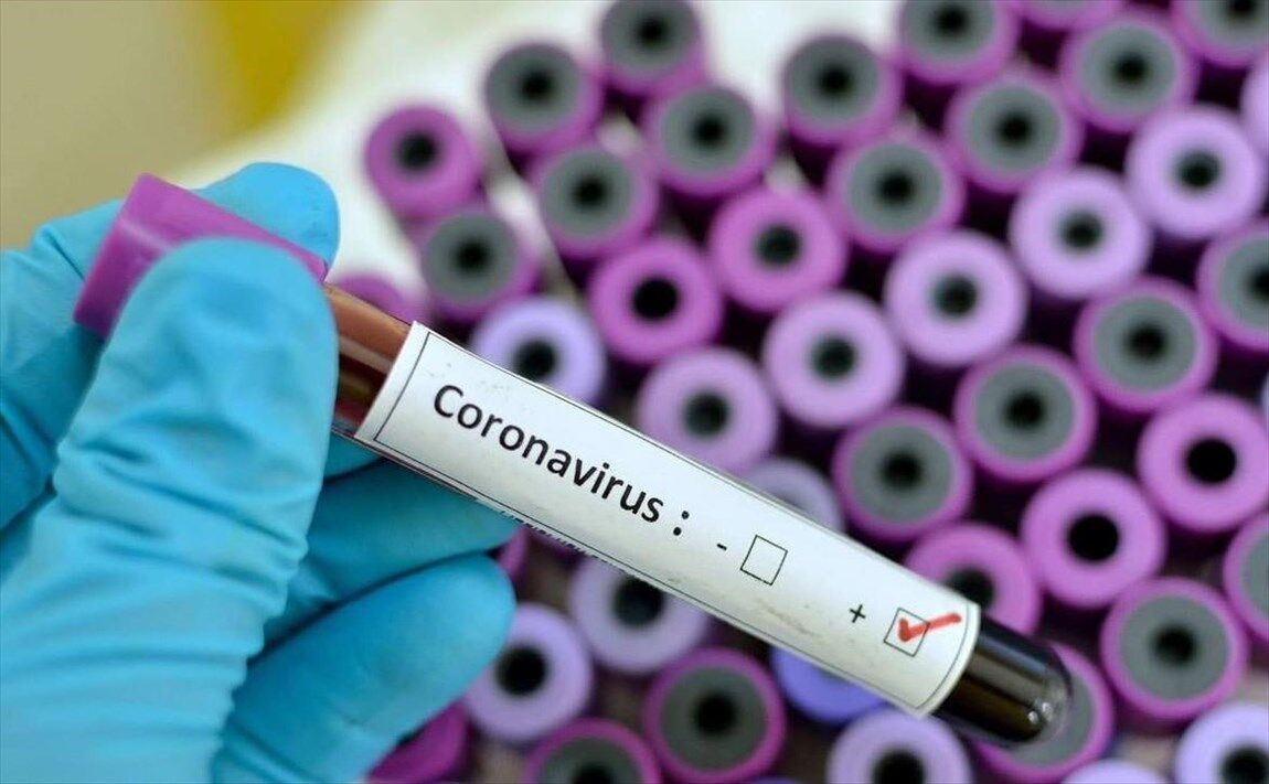 شناسایی ۹ مورد جدید ابتلا به کروناویروس در فارس