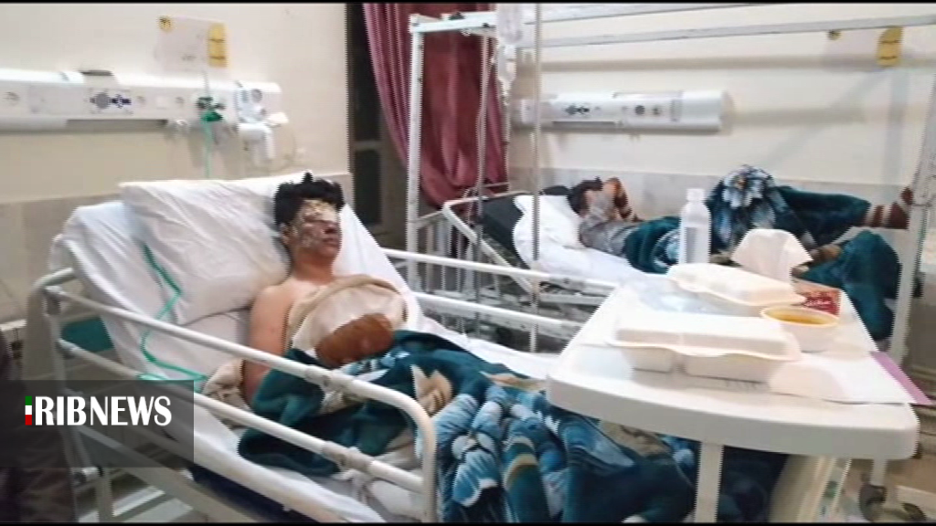 مصدومیت 3 نوجوان اردبیلی بار اثر انفجار بمب دست ساز و ترقه