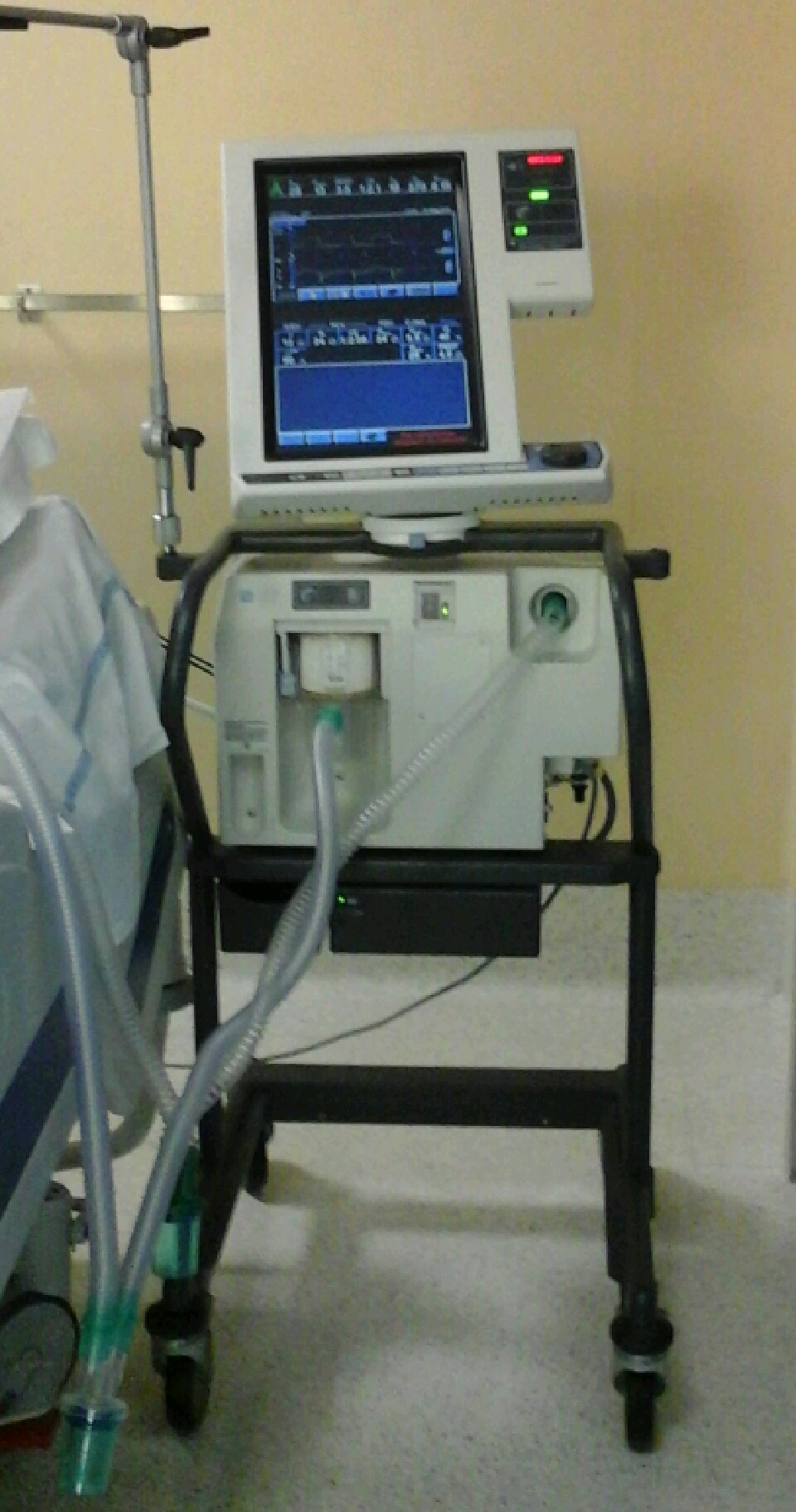 خریداری و اهداء یک دستگاه تنفس مصنوعی به بیمارستان واسعی سبزوار