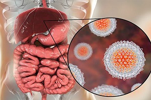 اصفهان پیشگام در درمان هپاتیت