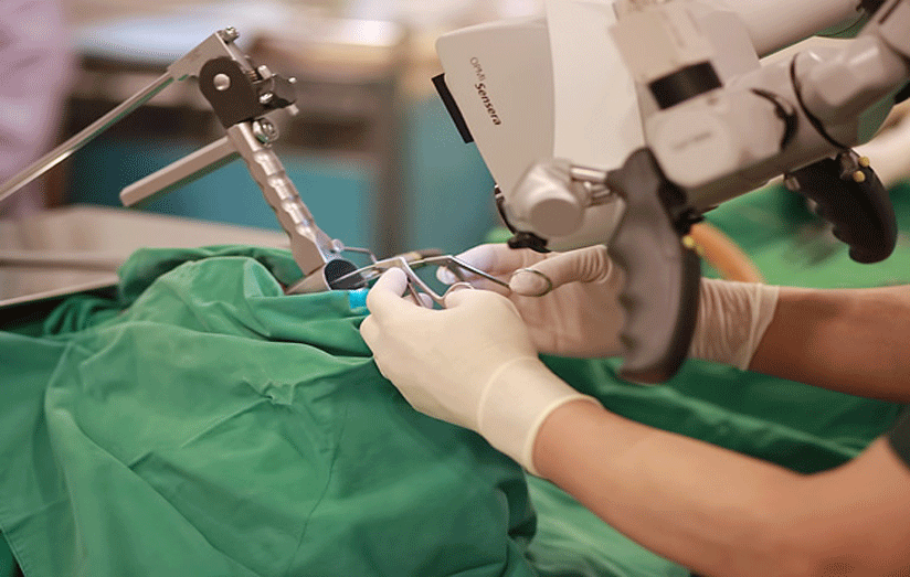 انجام عمل جراحی میکروسکوپی بر روی مغز بیمار در لامرد