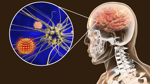 کرونا چه تأثیری بر مغز و اعصاب می‌گذارد؟