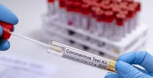 آیا کیت‌های تشخیص کرونا، نوع ویروس جهش یافته را مشخص می‌کند؟