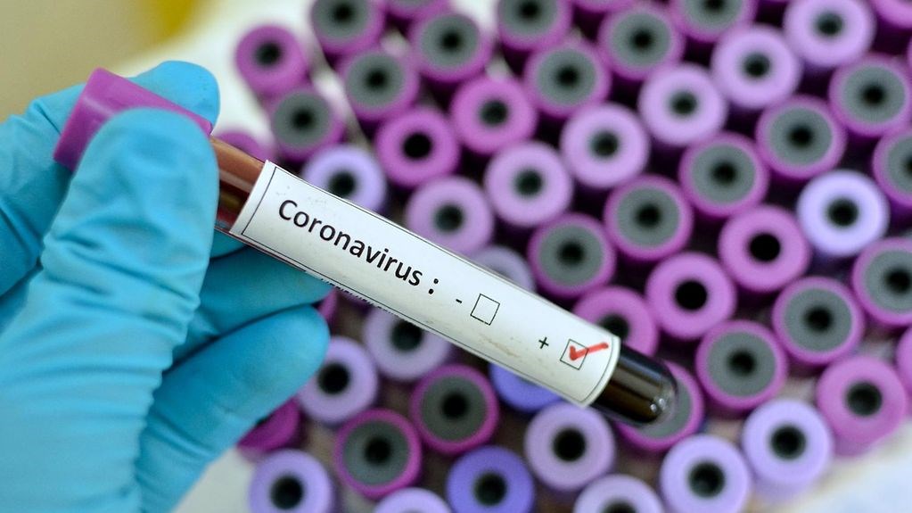 شناسایی ۷۳ مورد جدید ابتلا به کروناویروس در فارس