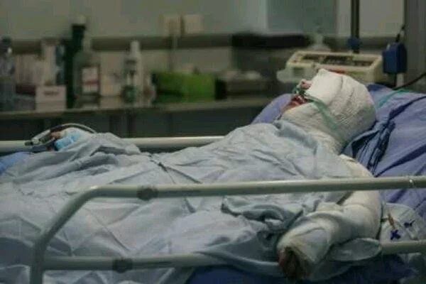 مداوای اولیه 3 بیمار سوختگی افغانستانی در تایباد