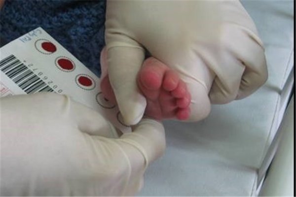 بیش از 7500 نوزاد تحت غربالگری کم کاری تیروئید نوزادان قرار گرفته اند