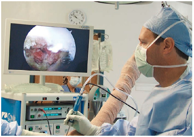 راه اندازی دستگاه آرتروسکوپی در مرکز آموزشی درمانی شهید دکتر بهشتی کاشان