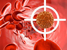 کشف روش جدید درمانی برای یکی از انواع سرطان خون