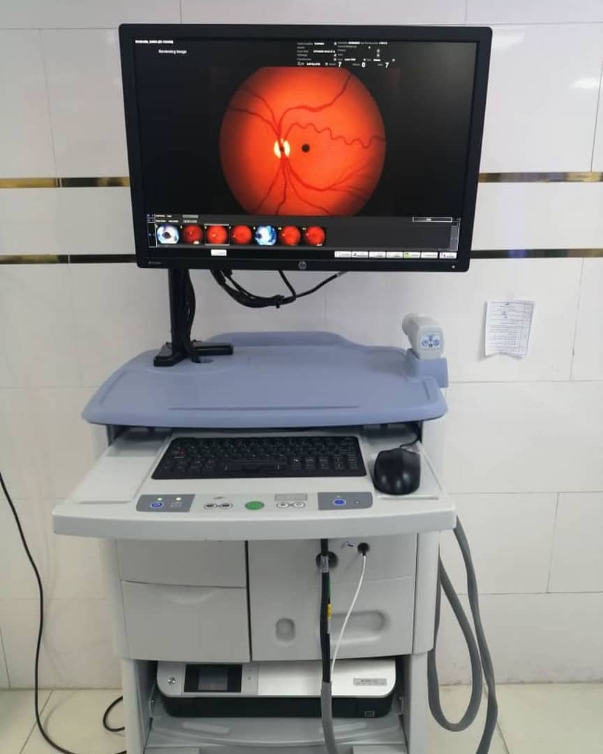 راه اندازی دستگاه عکسبرداری شبکیه چشم نوزادان نارس