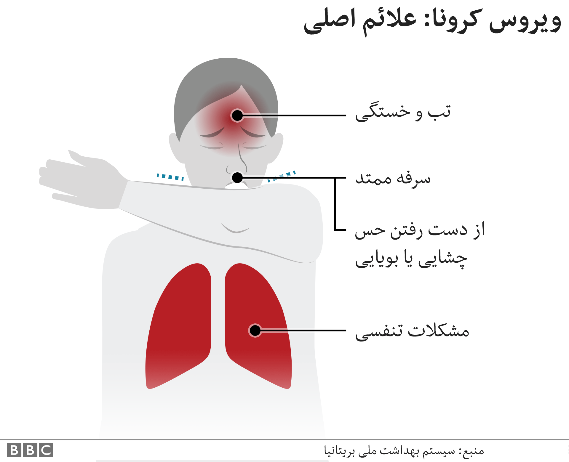 چه سرفه‌ای نشانه کروناست؟