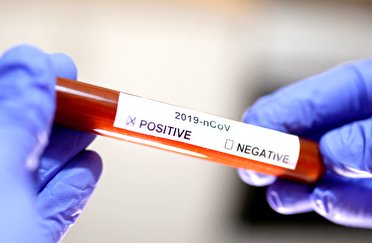  شناسایی 82 مورد جدید مبتلا به کرونا ویروس