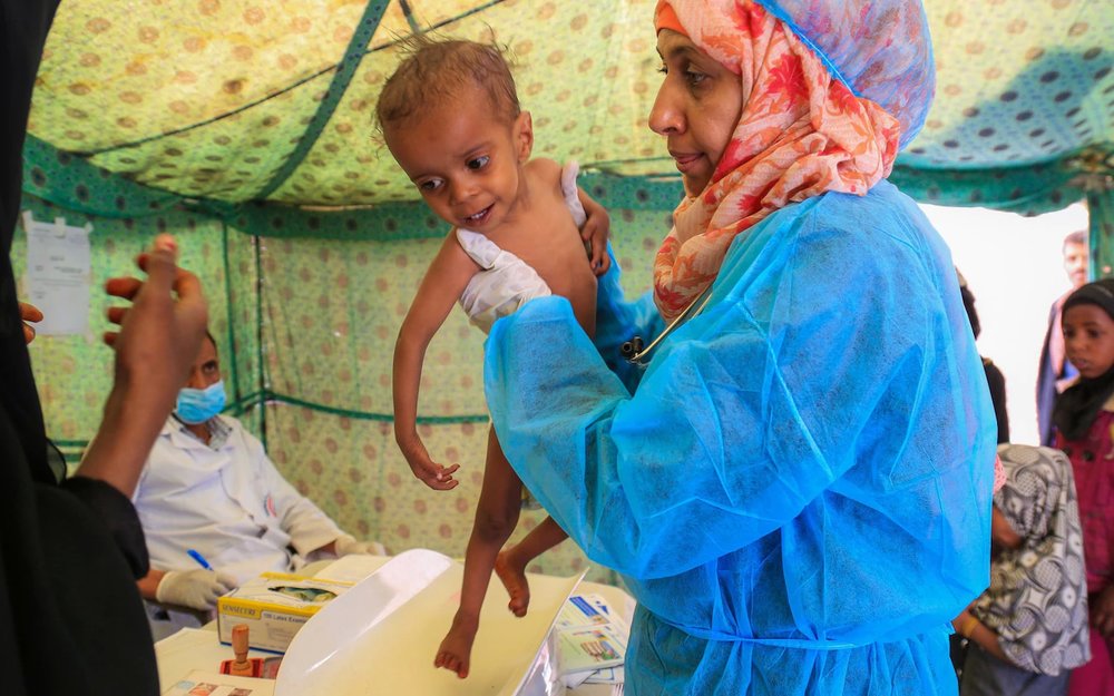 افزایش شدید کودکان مبتلا به سوء تغذیه در يمن