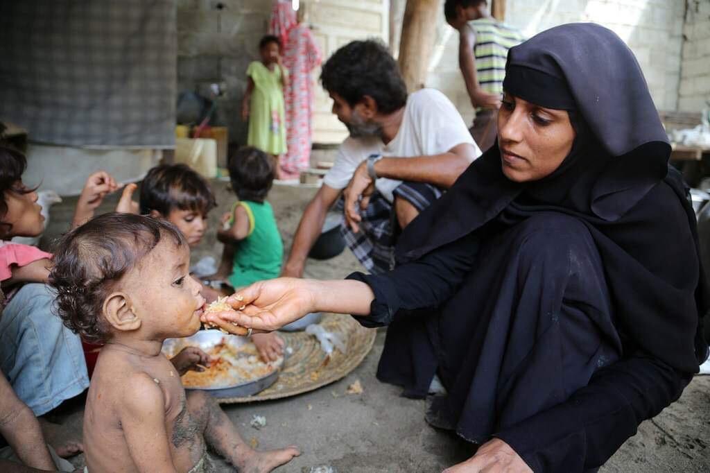 هشدار سازمان ملل درباره وخامت امنیت غذایی در یمن