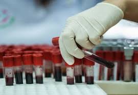 اضافه شدن 4 شهرستان خراسان جنوبی به ارائه  خدمات بانک خون بند ناف