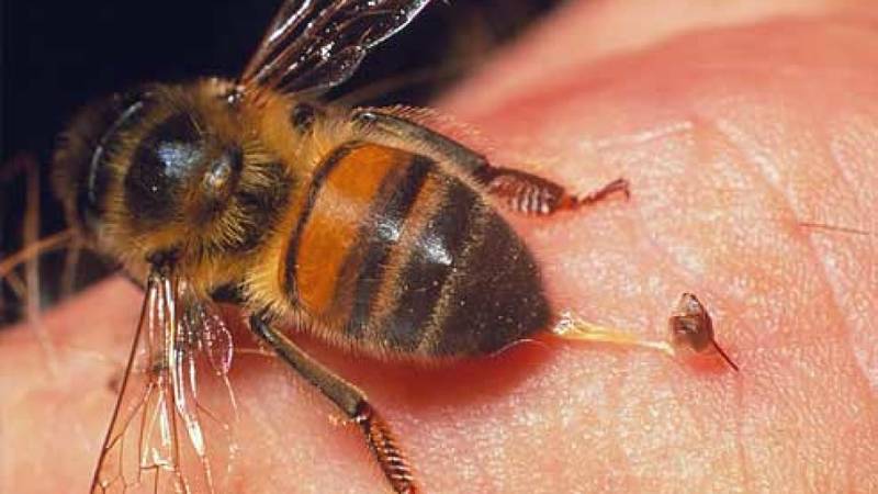 زهر زنبور عسل قاتل سلول های سرطانی