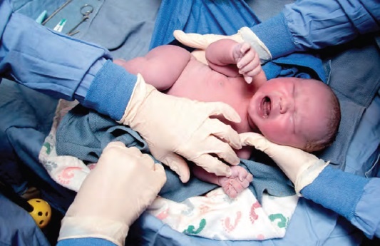 تولد 22 نوزاد از مادران مبتلا به کرونا در اردبیل