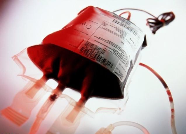 کمبود ذخایر خون در استان و ضرورت اهداء پلاسما