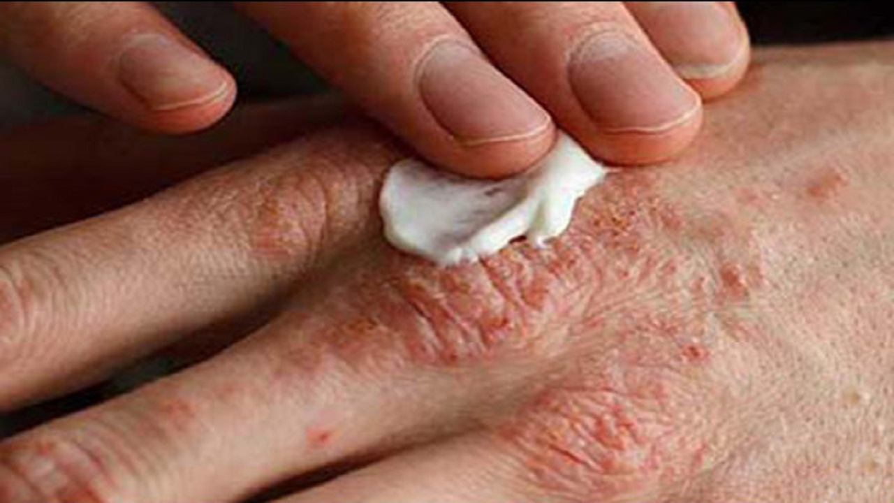 راهکار داشتن پوست سالم در فصل سرما