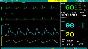 اضافه شدن دستگاه مانیتوریگ علایم حیاتیدر سپیدان