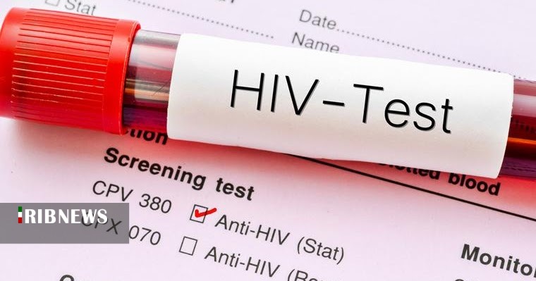 شناسایی 8 بیمار مبتلا به HIV