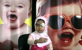 غربالگری بیش از ۲۲ میلیون کودک در طرح پیشگیری از تنبلی چشم