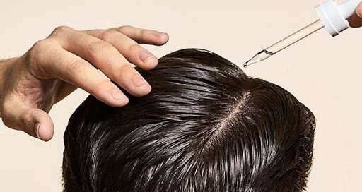 راهکار‌های موثر برای جلوگیری از ریزش مو