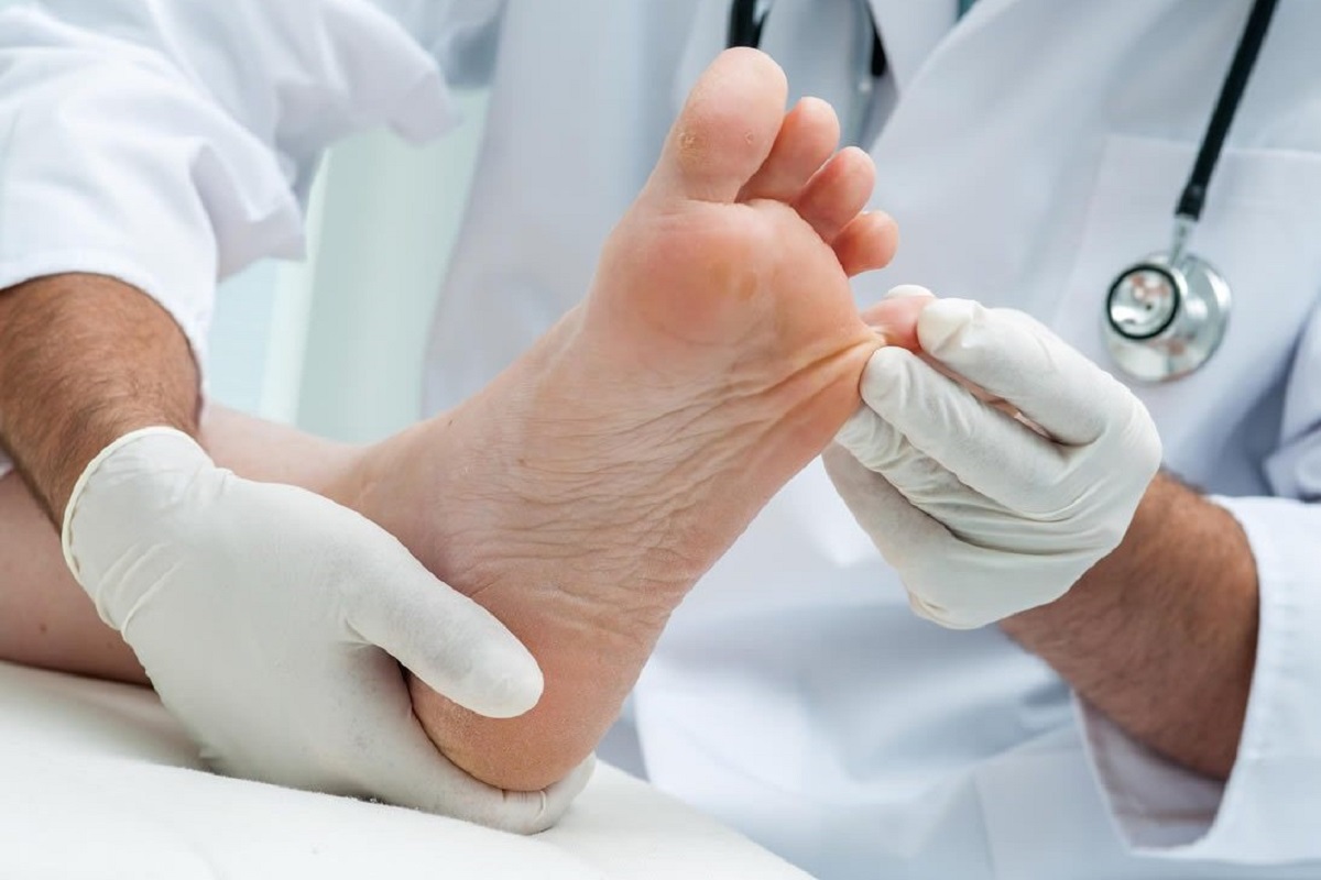 بیماری پای ورزشکاران چیست؟