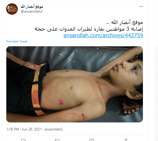 زخمی شدن سه شهروند یمنی در حجه