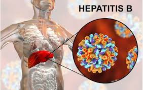 همه چیز درباره بیماری هپاتیت ب