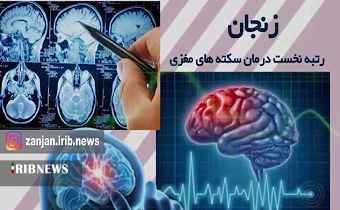 زنجان ؛ پیشتاز جهان در درمان سکته مغزی