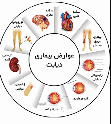 آشنایی با دیابت و علائم آن، اولین گام برای کنترل  این بیماری