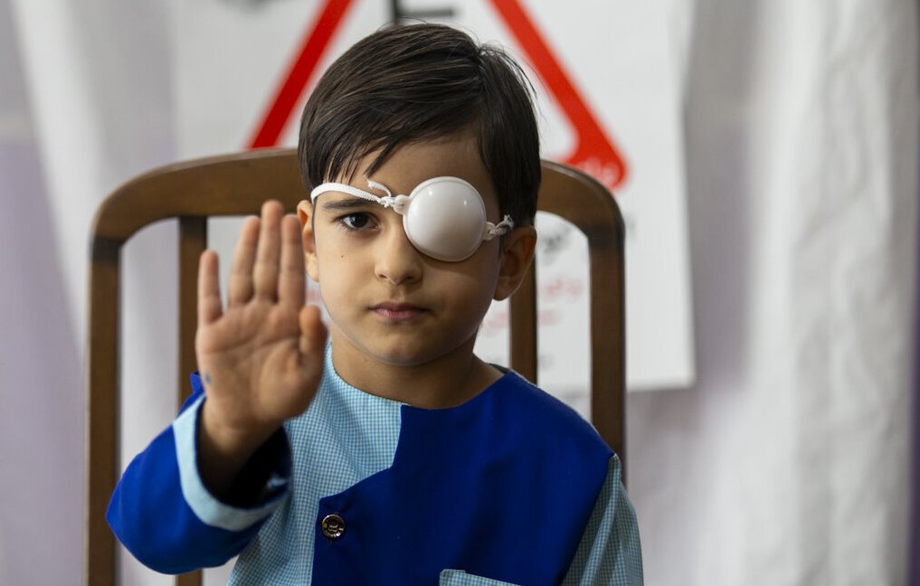 ۱۴۰ هزار کودک زیر پوشش غربالگری بینایی قرار می‌گیرند
