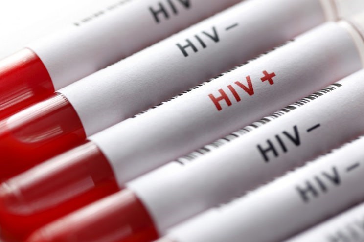 آموزش و اطلاع‌رسانی یکی از مهم‌ترین استراتژی‌های پیشگیری از ایدز
