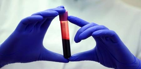 رشد ۱۰ درصدی تأمین خون در شبکه ملی خون رسانی