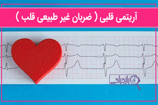 درمان آریتمی پیشرفته قلبی در مازندران